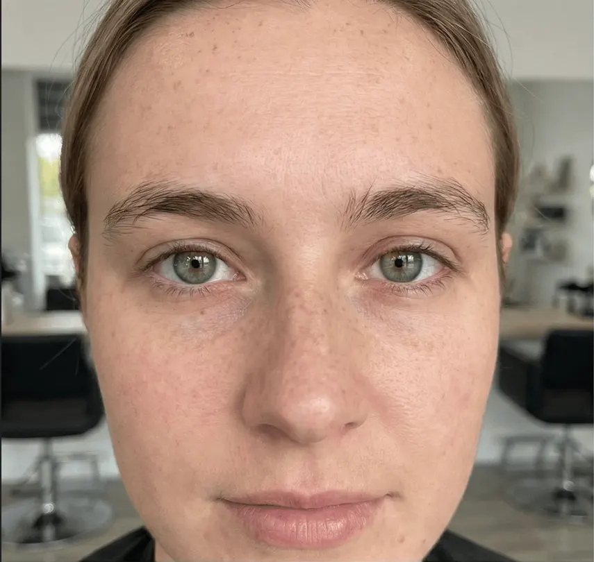 Olhos antes do procedimento
